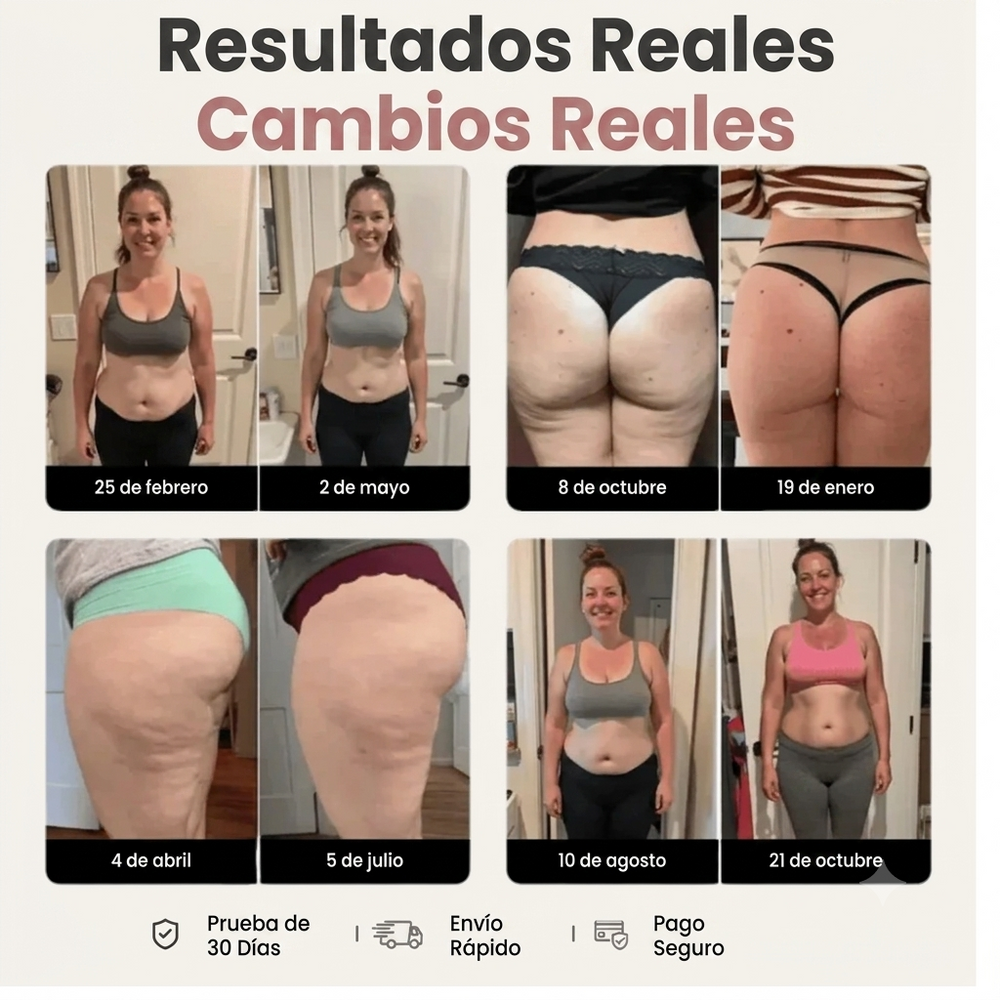 Mallas Reductoras 3D Cellumove